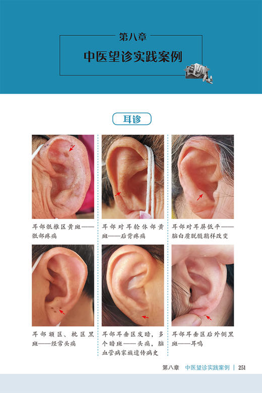 图解耳诊面诊眼诊手诊 中医诊病手段有望闻问切 对疾病的定性定位定量定质一体化诊断 姜军作等 人民卫生出版社9787117331616 商品图4