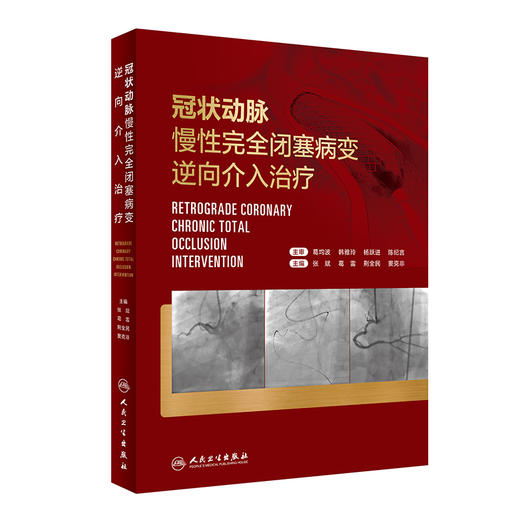 冠状动脉慢性完全闭塞病变逆向介入治疗 逆向介入对心血管造影 适应证判断 微通道建立 张斌等 人民卫生出版社9787117334204 商品图1