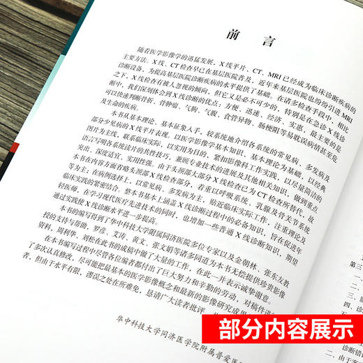 Z包邮正版X线读片指南 精装 临床影像诊断丛书 x线检查书籍鉴别诊断图书放射诊断学系列临床影像读片入门书籍北京大学医学出版社 商品图3