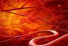  心脑血管问题秋季横行，血液垃圾是天敌 