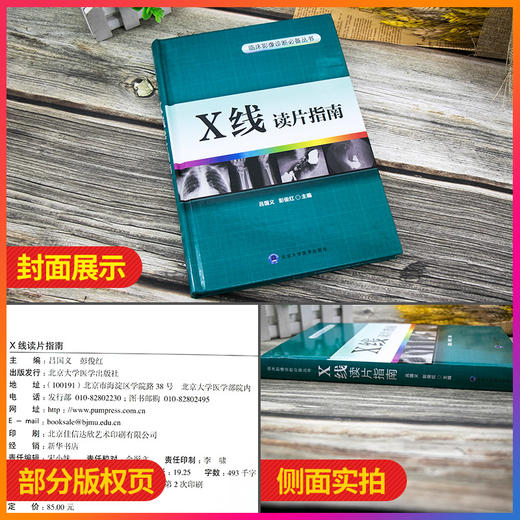 Z包邮正版X线读片指南 精装 临床影像诊断丛书 x线检查书籍鉴别诊断图书放射诊断学系列临床影像读片入门书籍北京大学医学出版社 商品图2