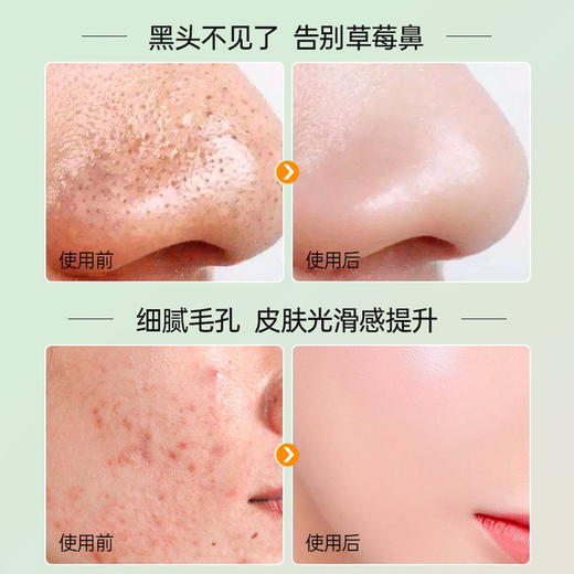 【99任选3件|均价￥33/件】清洁泥膜涂抹式去黑头粉刺闭口深层收缩毛孔补水保湿女男专用面膜 商品图2
