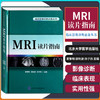 Z包邮正版MRI读片指南 轻松学习心电图 医学影像技术学 x线诊断报告书写技巧 中华影像医学 超声报告书写示例 北京大学医学出版社 商品缩略图1