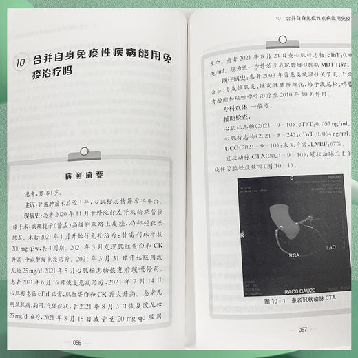 肿liu心脏病学真实世界病例索骥 商品图4