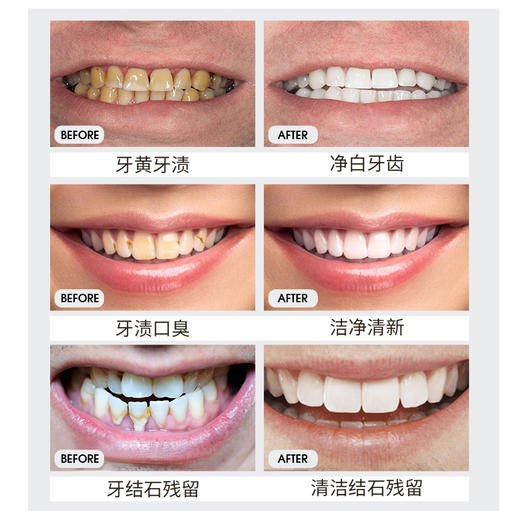 【99任选3件|均价￥33/件】漱口水便携持久留香味清洁口腔男女士去除|儒意官方旗舰店 商品图3