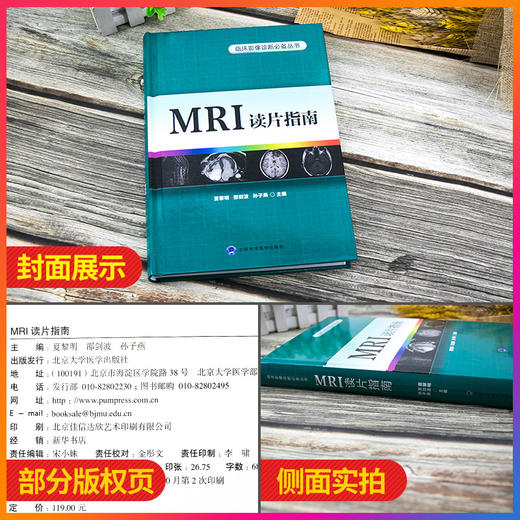 Z包邮正版MRI读片指南 轻松学习心电图 医学影像技术学 x线诊断报告书写技巧 中华影像医学 超声报告书写示例 北京大学医学出版社 商品图2