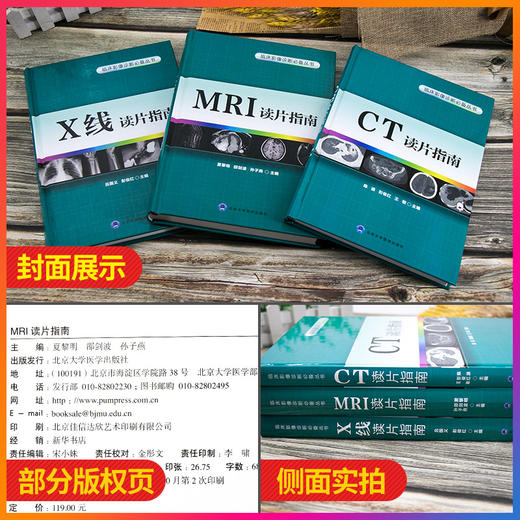 CT读片指南+MRI读片指南+X线读片指南 3本套装 影像医学 医学影像技术学 中华影像医学 临床影像诊断丛书 北京大学医学出版社 商品图2