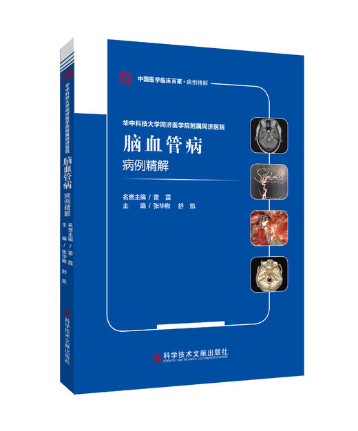 正版 华中科技大学同济医学院附属同济医院脑血管病病例精解 张华楸   舒凯主编 商品图0