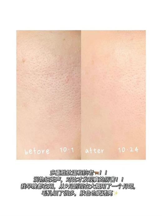 3.0版全面升级！珀莱雅红宝石面霜中样15g/50g轻盈/轻润/滋润 商品图6