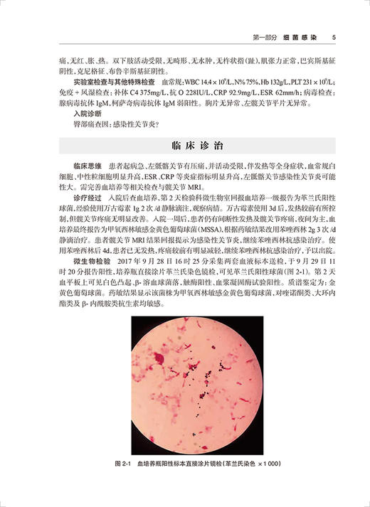 感染性疾病与临床微生物检验案例解析 刘文恩主编 细菌真菌病原体微生物学实验诊断临床思维 人民卫生出版社9787117334075 商品图4