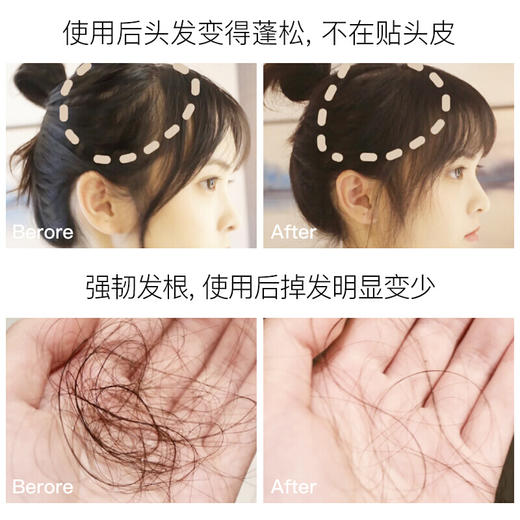 ReEn睿嫣 韩国进口控油去屑花香洗发水护发素组合装 500ml/瓶 商品图4