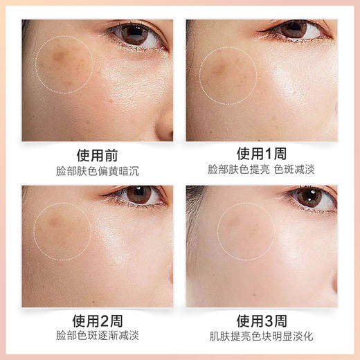 【微信会员专享】瑜然美玫瑰精油开背按摩全身通经络刮痧面部精油女男士官方正品 商品图2