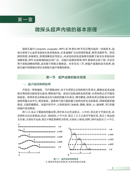 无货已下架 微探头超声内镜的临床应用 胡端敏 诸琦主编 真实临床病例超声基本原理 内窥镜检超声波诊断内科学 人民卫生出版社9787117333115 商品图4