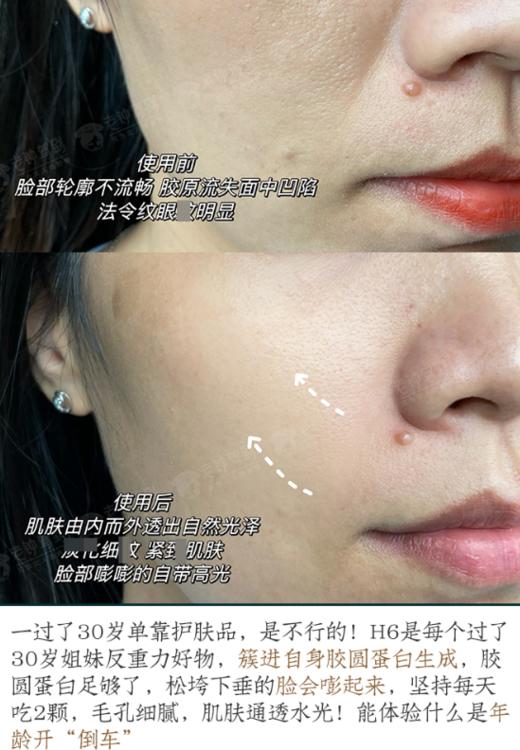 【新品】概念180H6反重力胶囊60粒 商品图2