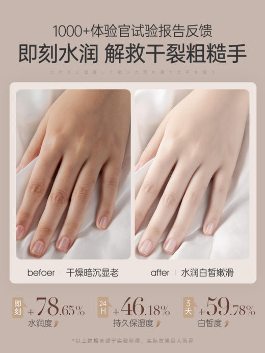 【⚡抢！79元任选2件】儒意美白护手霜300g 滋润保湿补水  清爽不油腻  |儒意官方旗舰店 商品图4