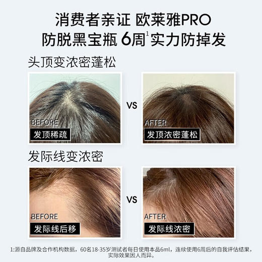 【新品】欧莱雅cn芯基源丰盈防脱精华液90ml（23.4） 商品图2