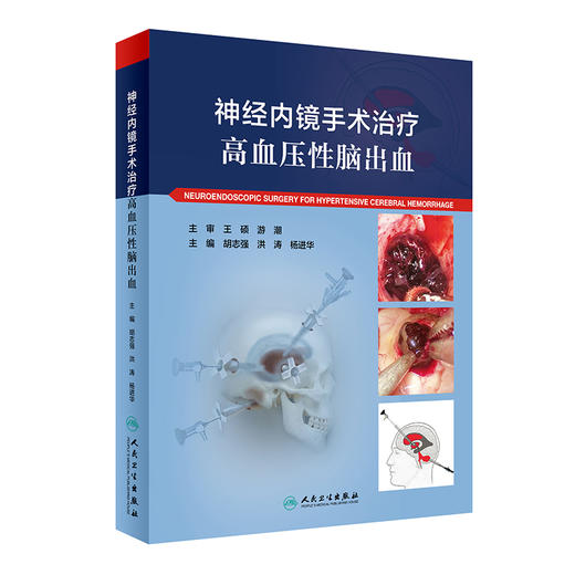 神经内镜手术zhi疗高血压性脑出血 2022年9月参考书 9787117332996 商品图0