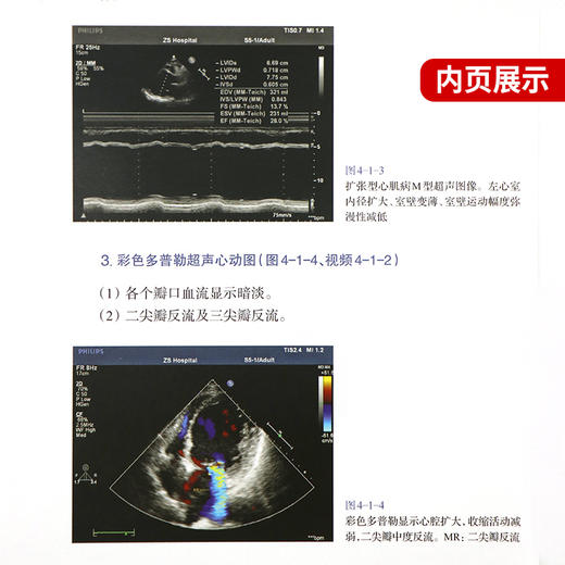 心脏超声入门  超声诊断要点和注意事项 商品图3