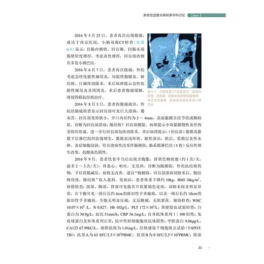 肠道疑难病例多学科讨论（第一辑）(精)/浙江大学出版社/曹晓沧、顾于蓓、李玥、梁洁、沈骏、田丰/第1辑/病例集/专著 商品图1