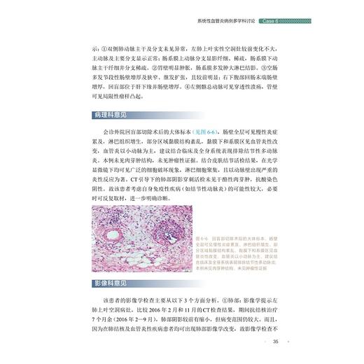 肠道疑难病例多学科讨论（第一辑）(精)/浙江大学出版社/曹晓沧、顾于蓓、李玥、梁洁、沈骏、田丰/第1辑/病例集/专著 商品图3