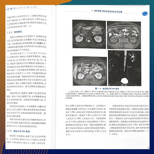 现代体部磁共振诊断学：泌尿生殖分册 商品图5