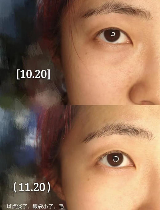 【新品上新】城野医生377美白精华28g 商品图1