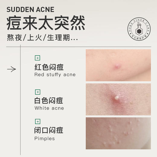 【品牌直发】柏翠丝净痘舒缓精华液10ml 商品图3