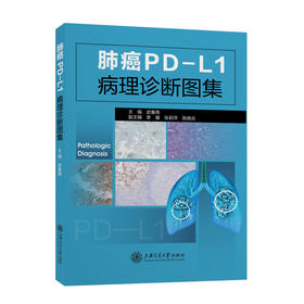 肺癌PD-L1病理诊断图集