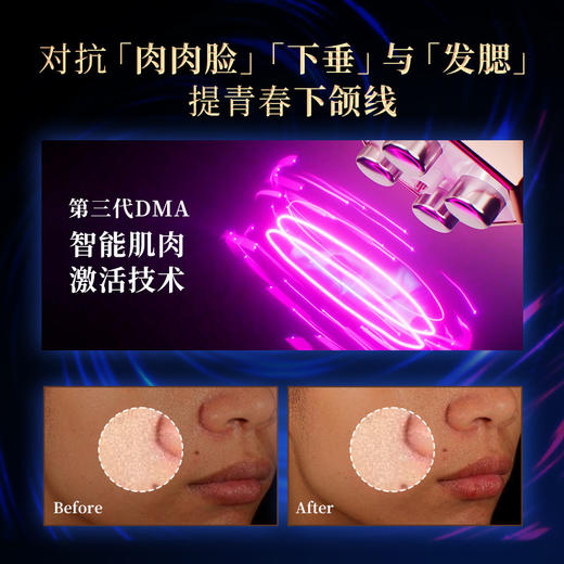 初普TriPollar 奇迹S 美容仪 射频仪 商品图1