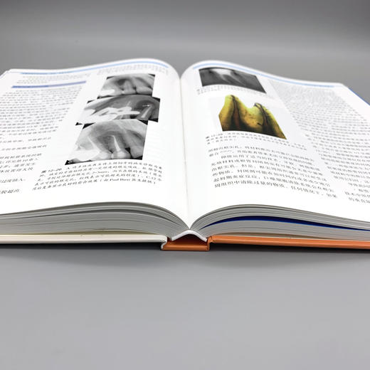 牙髓病临床病例释疑 预防诊断与治疗 译 程小刚 仇珺T牙体牙髓病可能碰到的各种疑难问题和解决之道 世界图书西安 9787519291013 商品图1