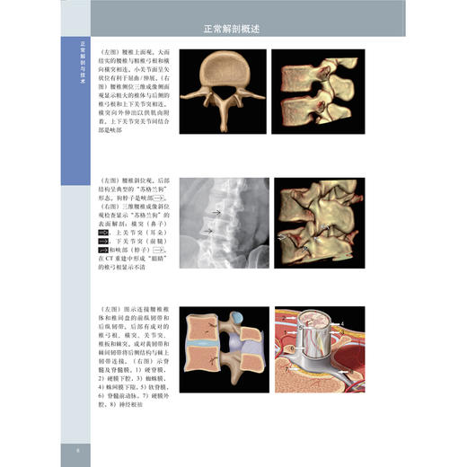 脊柱外科影像学 商品图5