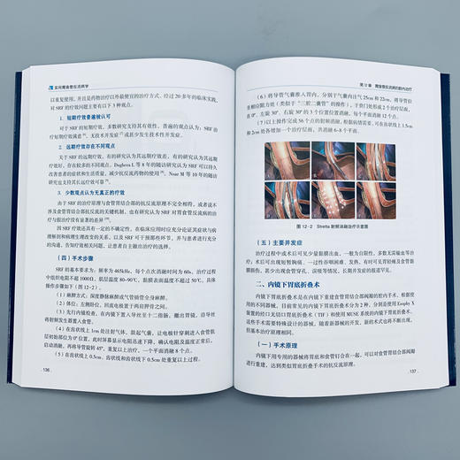 实用胃食管反流病学 商品图3