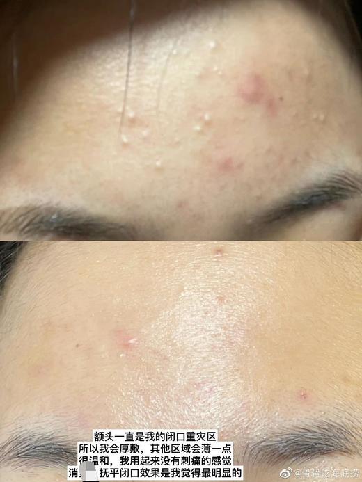 【exp26年6月】嫩滑去闭口！proya珀莱雅多酸复合面膜7ml 商品图6