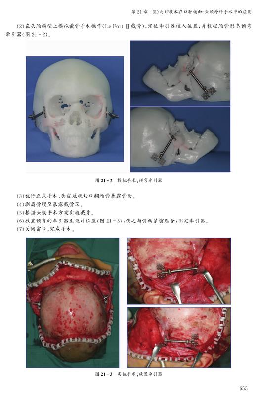 口腔颌面-头颈外科手术学（第2版） 商品图6