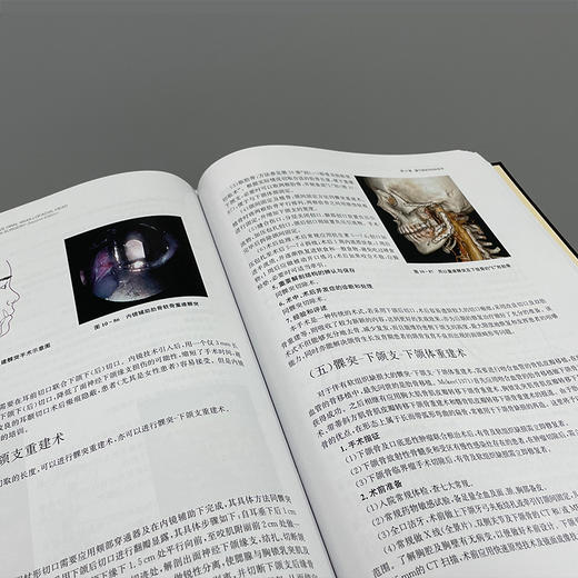 口腔颌面-头颈外科手术学（第2版） 商品图3