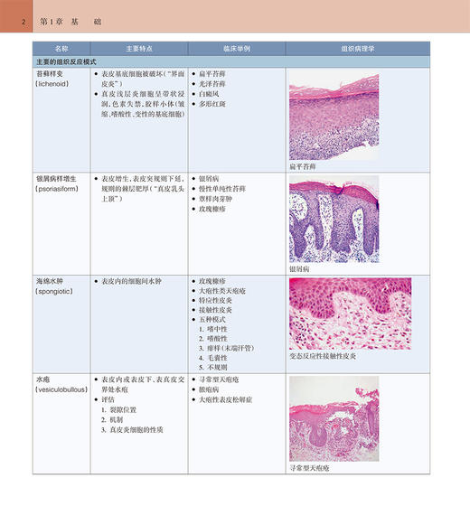 Weedon皮肤病理学精要 第2版 张韡 乔建军 皮肤病理学诊断要点概览列表形式排列利于初学者高效学习 人民卫生出版9787117325073 商品图4