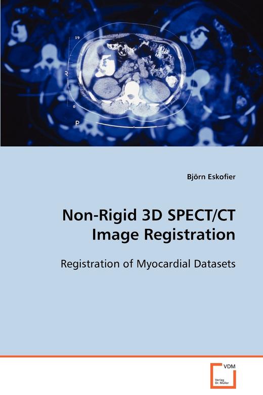 【预售 按需印刷】Non-Rigid 3D SPECT/CT Image Registration 商品图0