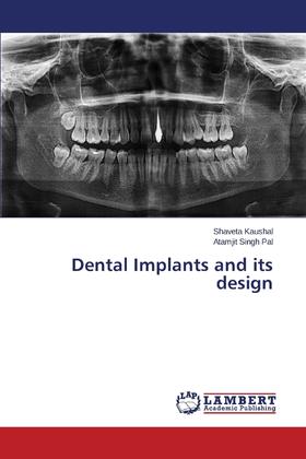 【预售 按需印刷】Dental Implants and Its Design