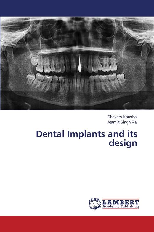 【预售 按需印刷】Dental Implants and Its Design 商品图0