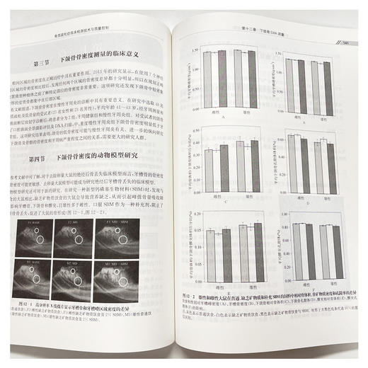 骨质疏松症临床检测技术与质量控制 商品图4