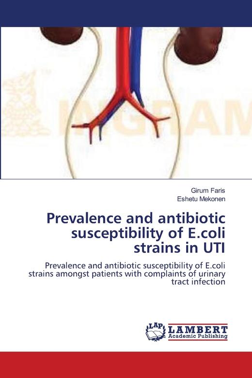 【预售 按需印刷】Prevalence and antibiotic susceptibility of E.coli strains in UTI 商品图0