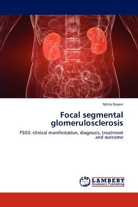 【预售 按需印刷】Focal segmental glomerulosclerosis