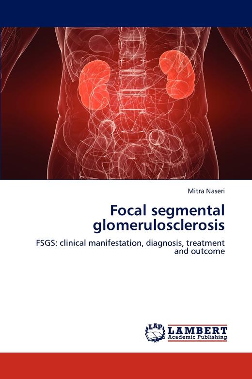 【预售 按需印刷】Focal segmental glomerulosclerosis 商品图0