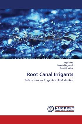 【预售 按需印刷】Root Canal Irrigants