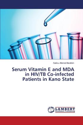 【预售 按需印刷】Serum Vitamin E and MDA in HIV/TB Co-infected Patients in Kano State