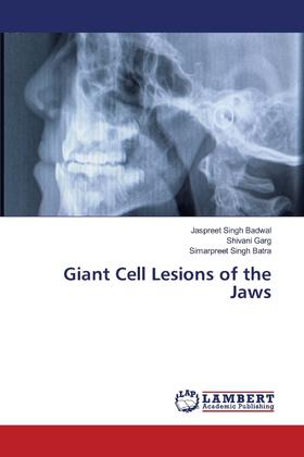 【预售 按需印刷】Giant Cell Lesions of the Jaws