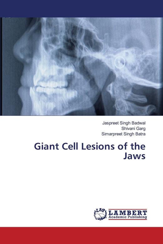 【预售 按需印刷】Giant Cell Lesions of the Jaws 商品图0