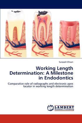 【预售 按需印刷】Working Length Determination