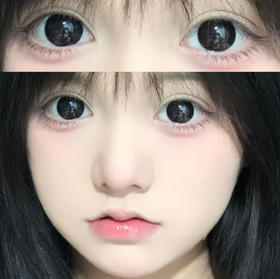 Gugucon球球黑（半年抛玻尿酸）