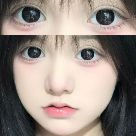 Gugucon球球黑（半年抛玻尿酸） 商品图0